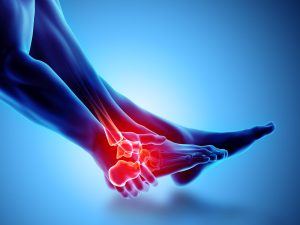 Heel Pain Treatment in Ahmedabad: Best Care for Plantar Fasciitis by Dr Ankit Kamothi