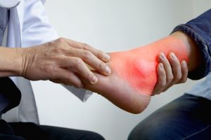 Rebuild, Realign, Restart — A Patient’s Roadmap to Charcot Foot Stability and Long-Term Confidence